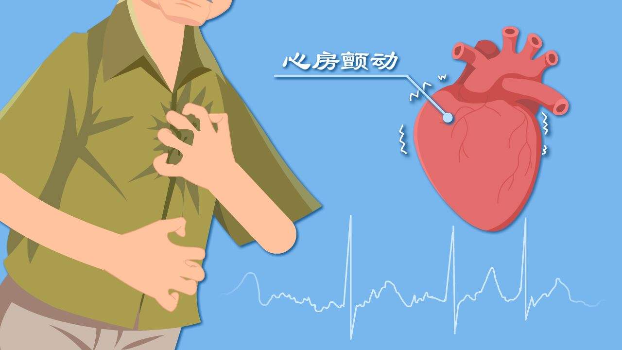 一问一答房颤没有症状需要治疗吗