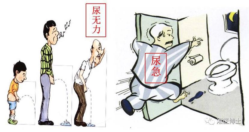会出现排尿等待时间延长,尿线变细,无力,射程短(常常弄湿裤脚),排尿
