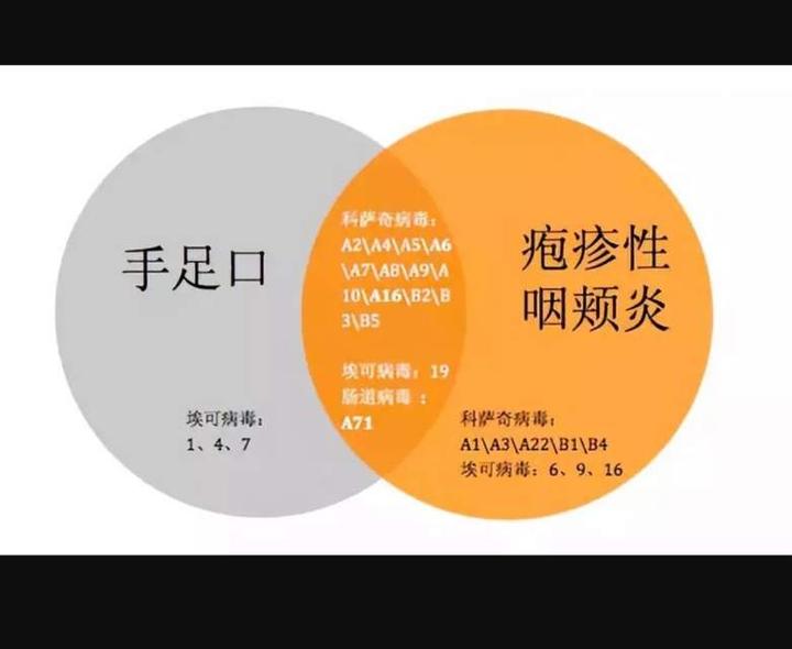 手足口病和疱疹性咽峡炎的不同