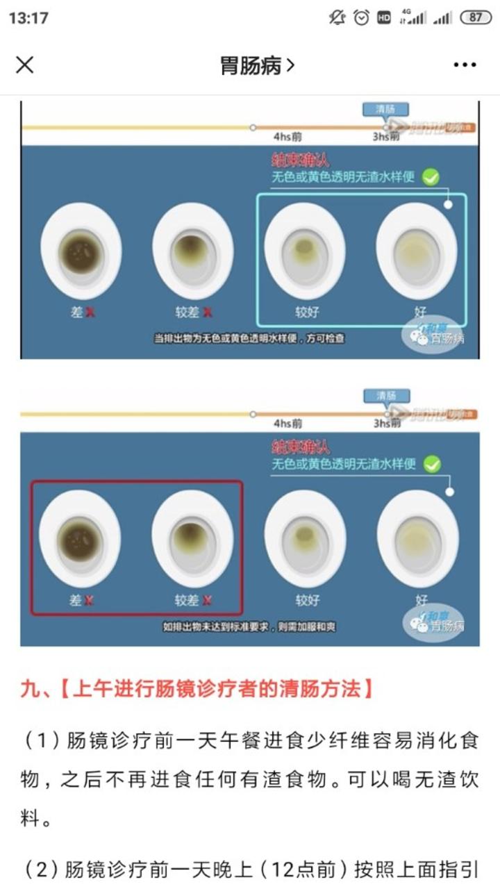 腸鏡檢查如何有效清腸這還真是個技術活