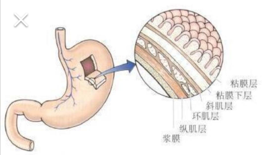 胃的解剖分层:1,什么是消化性溃疡:指黏膜缺损达到或者超过黏膜肌层