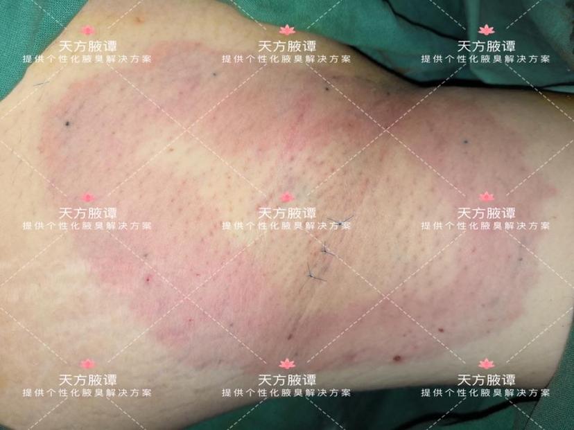 排汗以水份和电解质为主,是没有味道的,另一种大汗腺又称顶浆腺,只