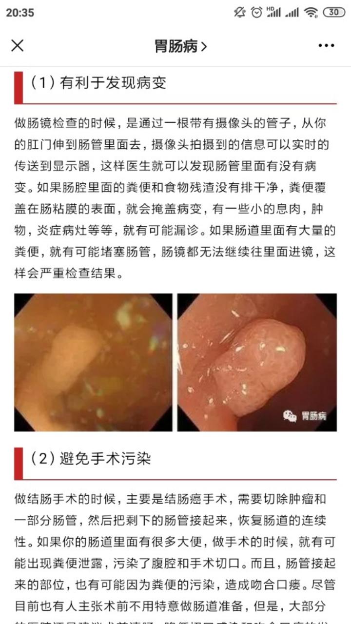 肠镜检查前如何清肠请收下这份最详细的指南