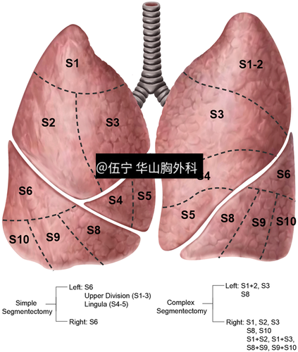 肺段和亚段图图片