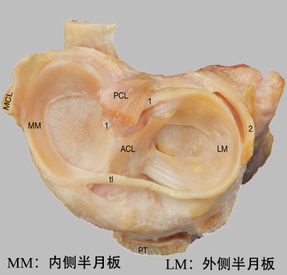 半月板是个啥东东?到底有什么作用?
