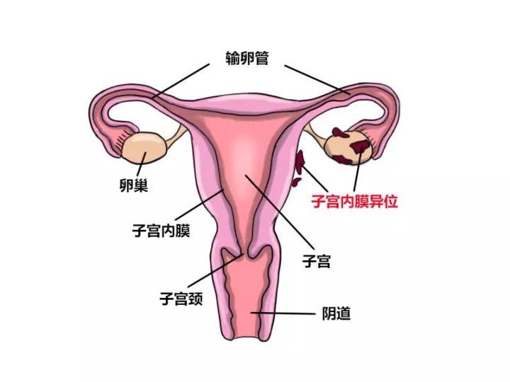 子宫位置正面图图片