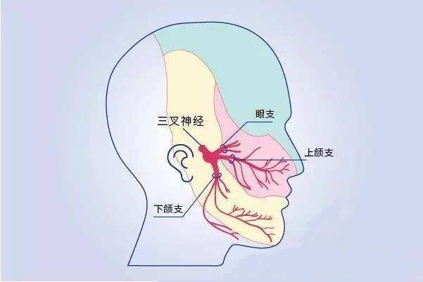 牙痛和三叉神经痛怎么来鉴别呢