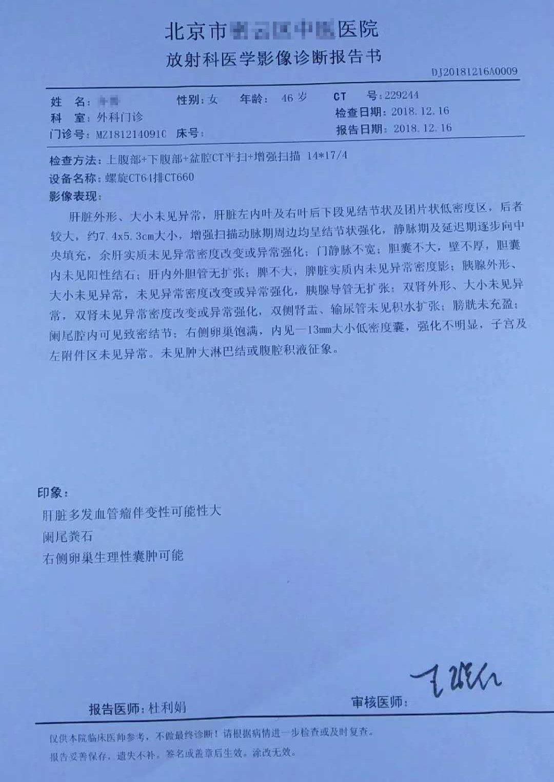 ct提示阑尾粪石,将来很容易反复发作阑尾炎,又合并肝脏右后叶血管瘤