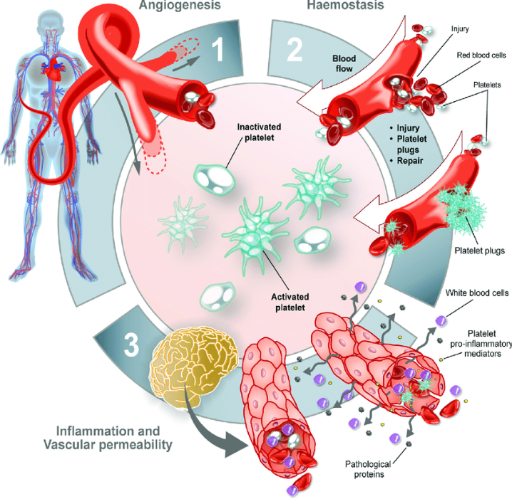 哈佛医学院麻省总医院:外周动脉疾病抗血小板治疗疗效男女有别 - 微医