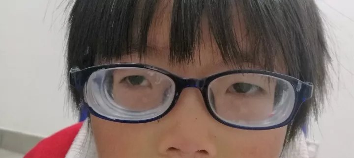 高度的近视,戴眼镜确实很影响外观戴眼镜,看到的东西可不是真实的世界
