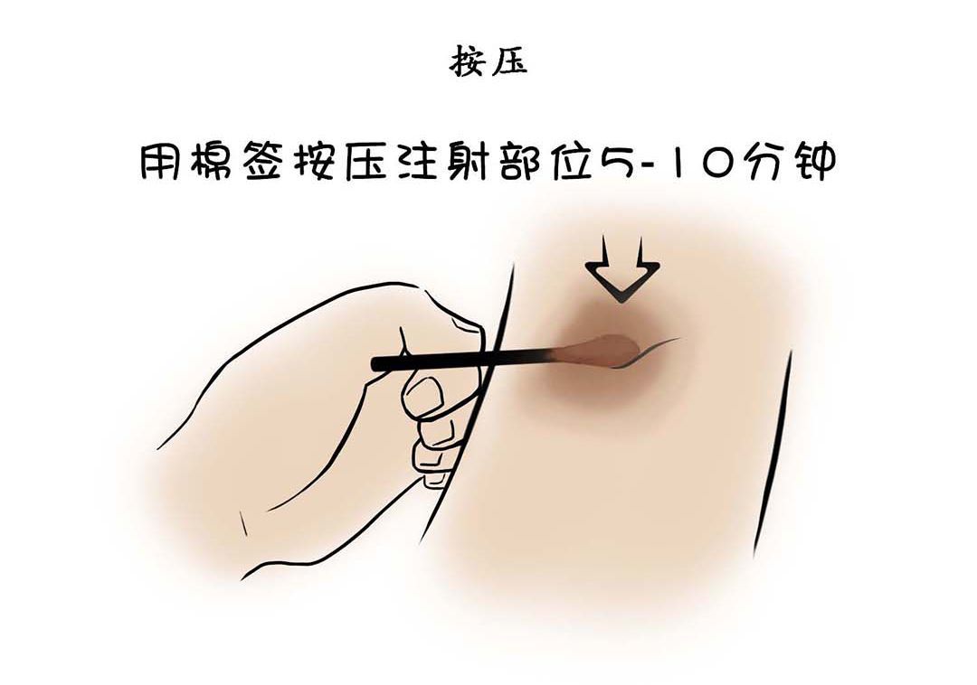 腹部注射肝素钠位置图图片