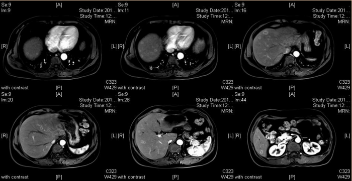 1bB128449747?resize=700:x