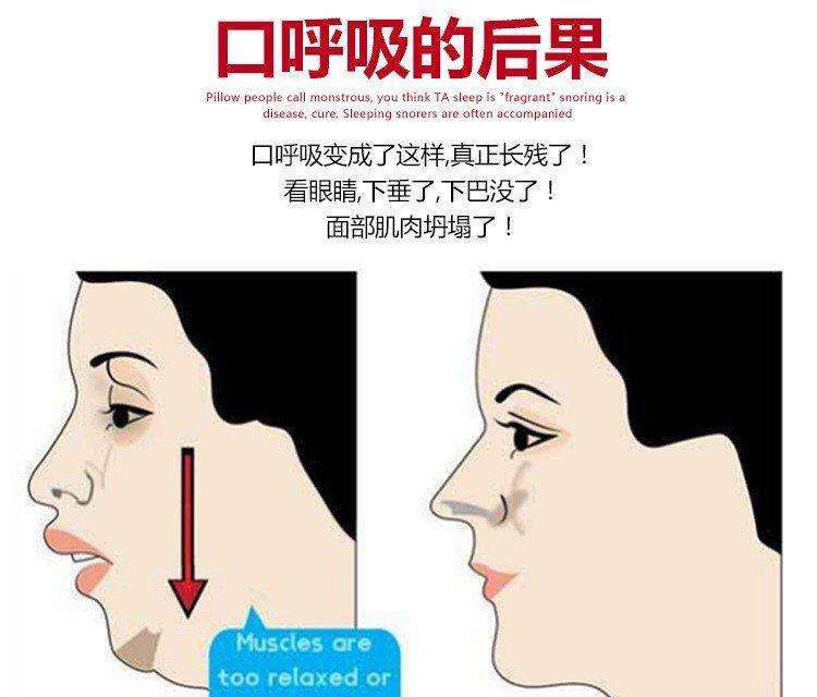 口呼吸的危害