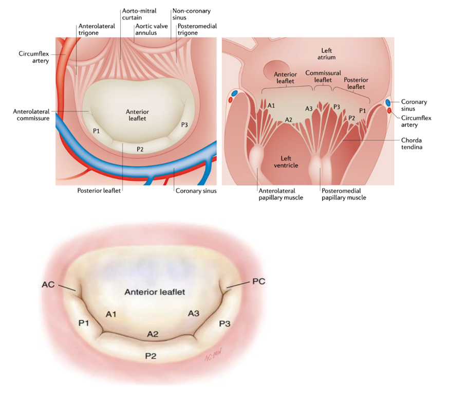 心衰为什么伴二尖瓣返流二尖瓣解剖