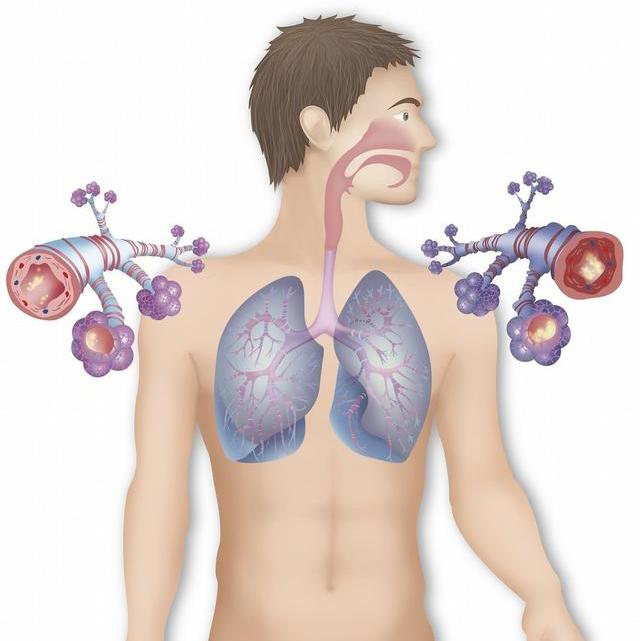哮喘患者不发作和正常人无差别发作起来威胁生命防治很重要