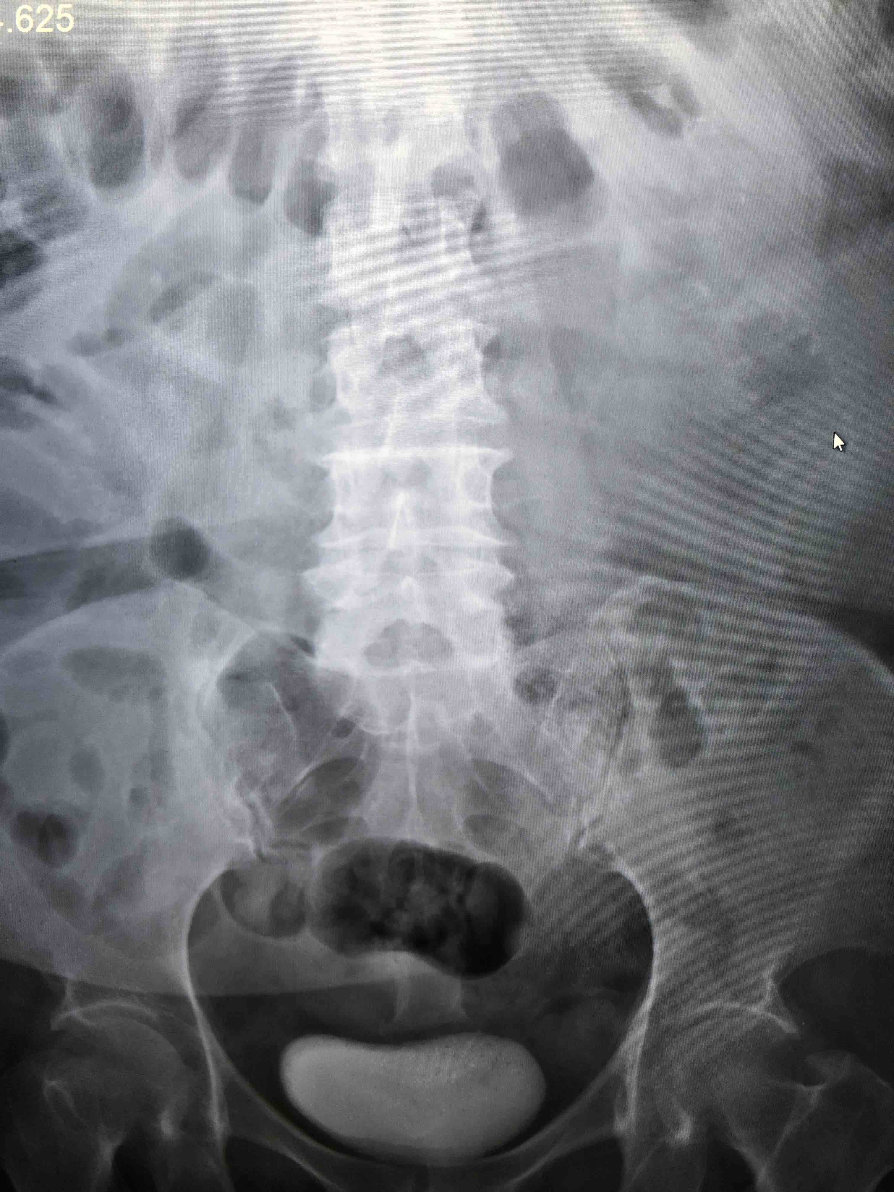 最难诊断的腹痛 - 微医(挂号网)