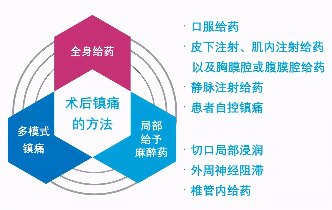 术后镇痛的方法多模式镇痛是指联合应用不同镇痛技术或不同作用机制的