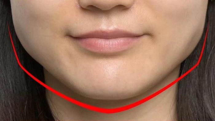 咬肌是面部咀嚼肌群之一,它位于颧弓和下颌角之间.