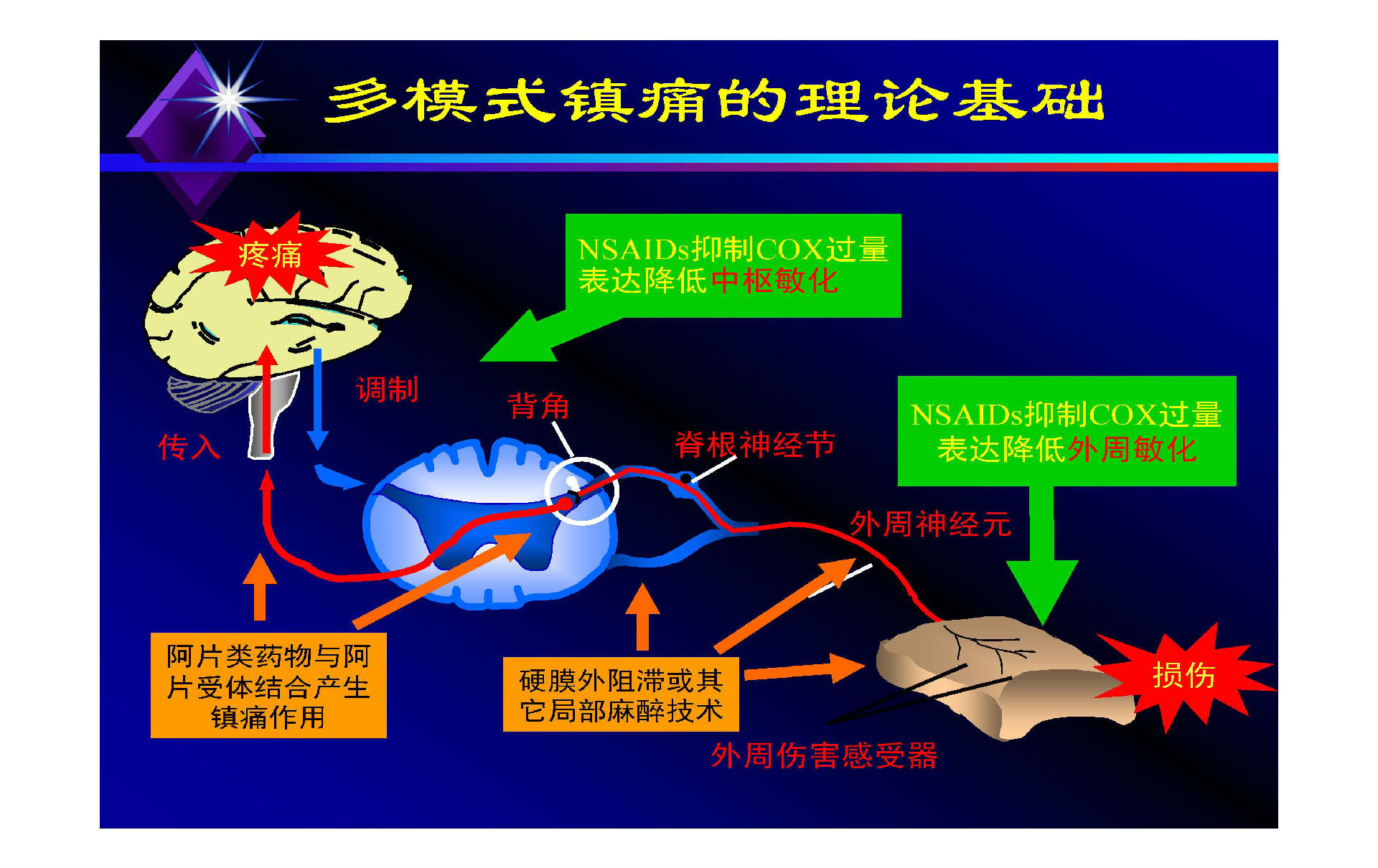 急性疼痛的多模式镇痛_王祥瑞医生文章_上海市东方医院北院-微医