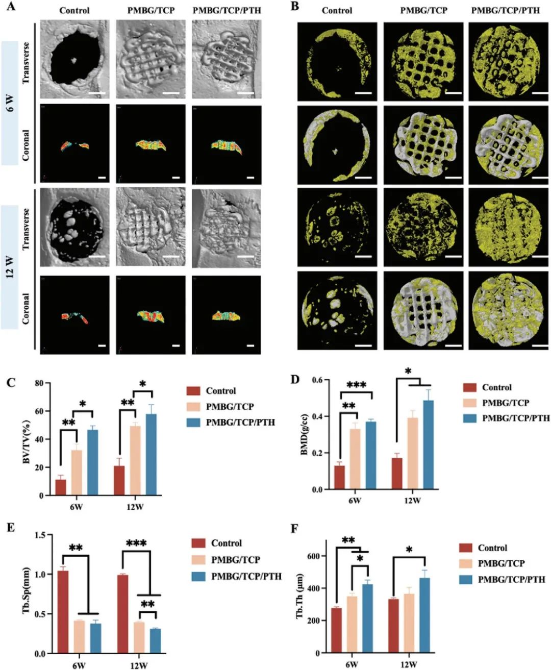 3d-pmbg-tcp-pth-1-34