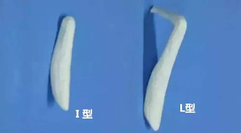 隆鼻假体会发生排异反应吗该如何进行处理