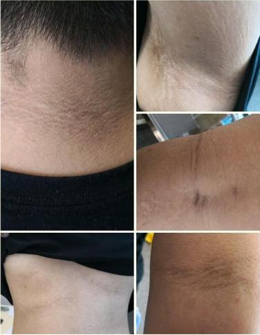 那些对肥胖的偏见:脖子黑是没洗干净? - 微医(挂号网)