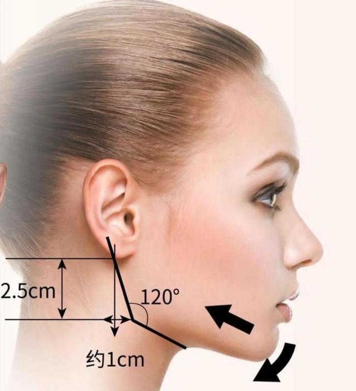 一般较好的角度在120度左右,小于120度或约等于90度的,下颌角就会呈现