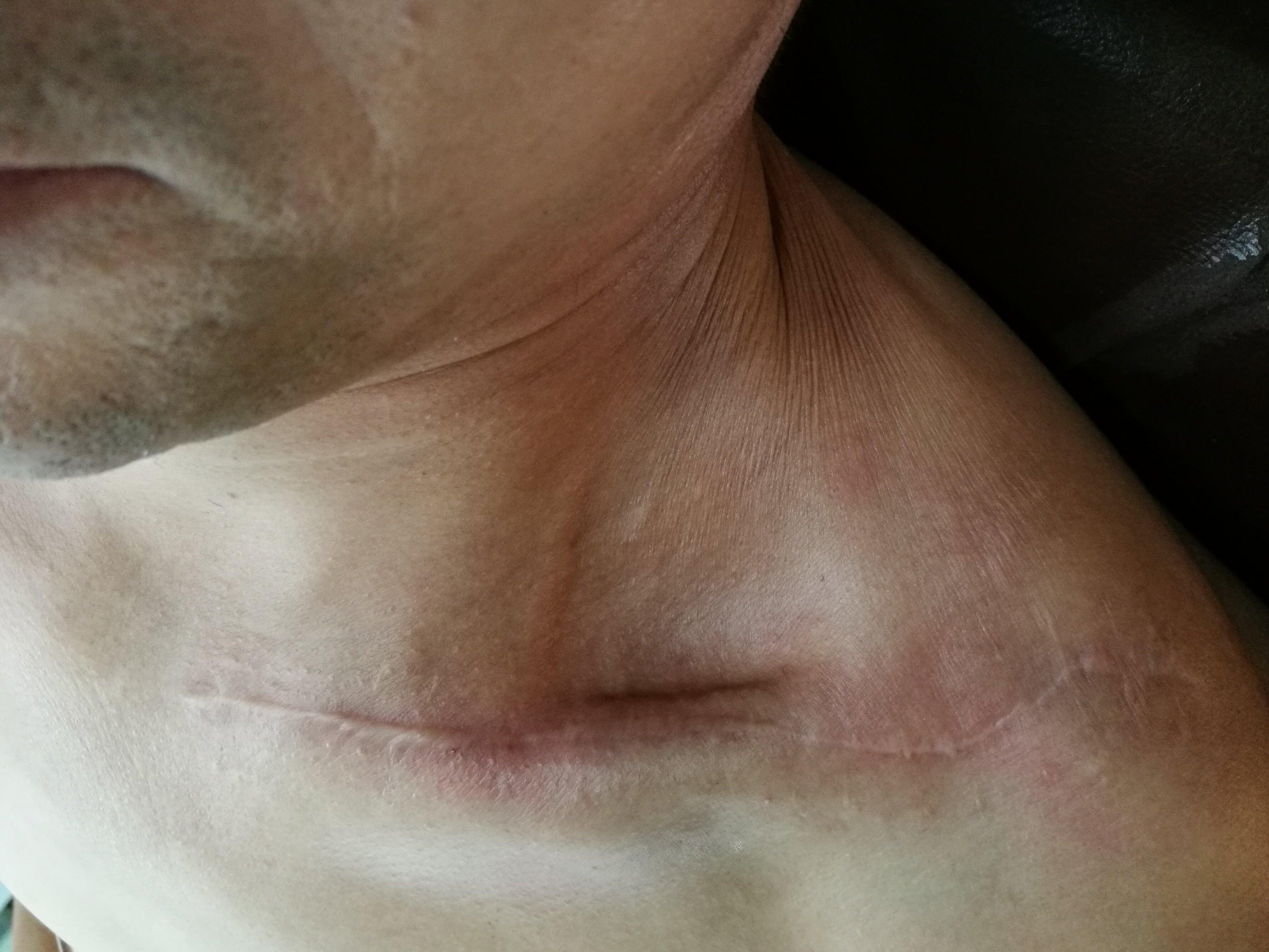 开展伤口美容缝合新项目