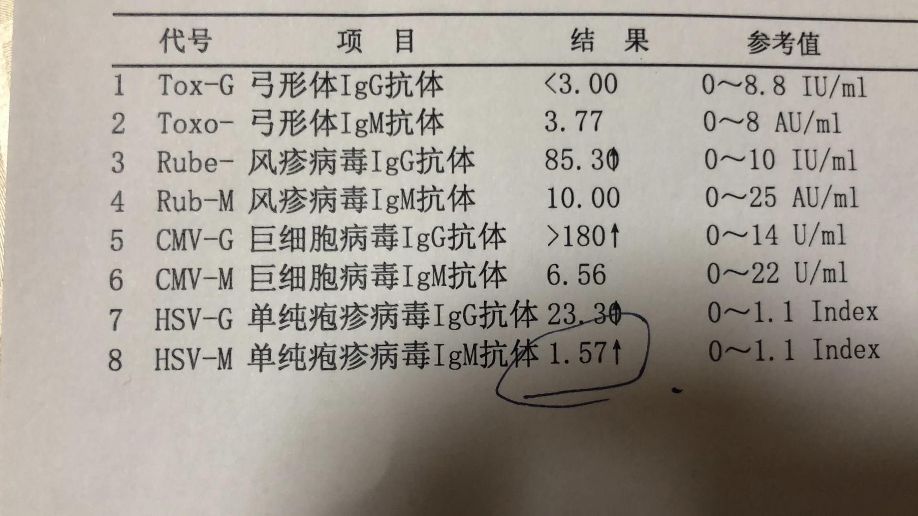 hsvm单纯疱疹病毒igm抗体157