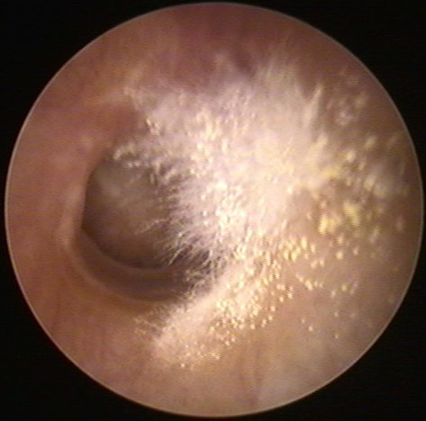 耳朵眼痒怎么解