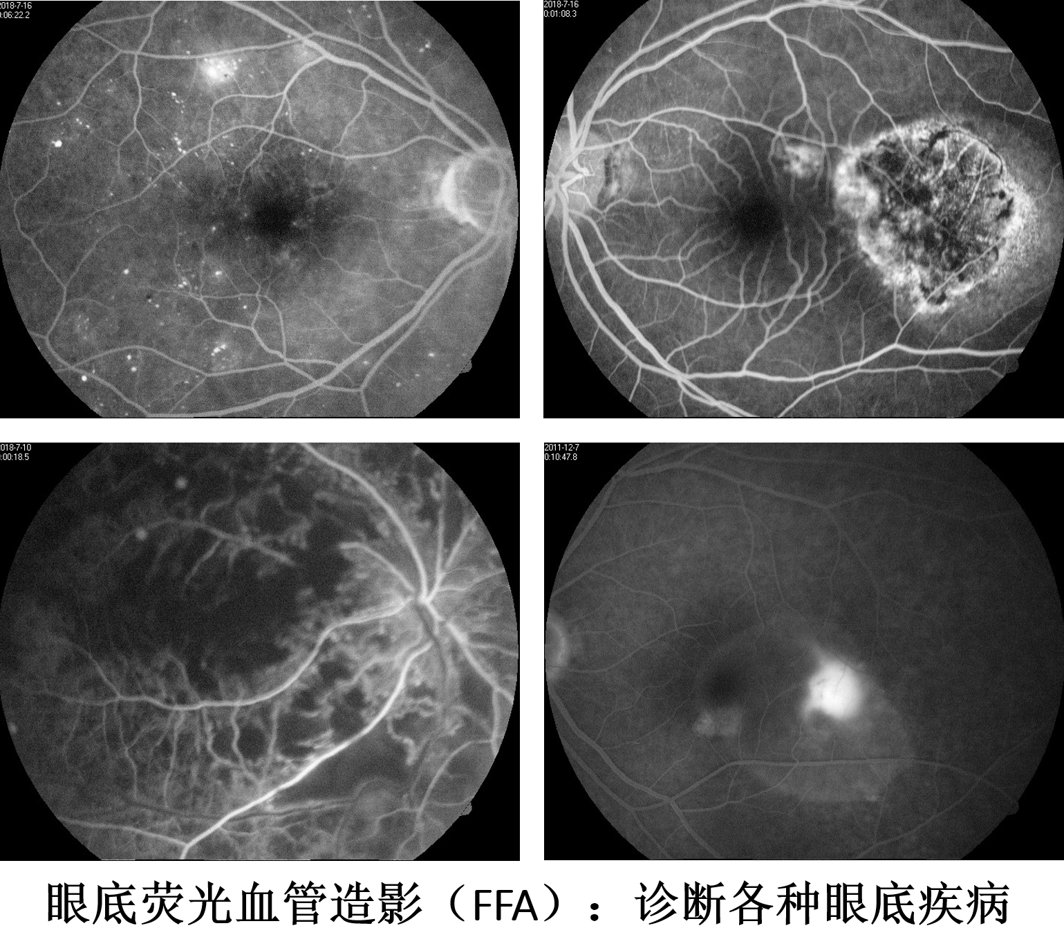 上海市浦东新区人民医院开设眼底病专科门诊