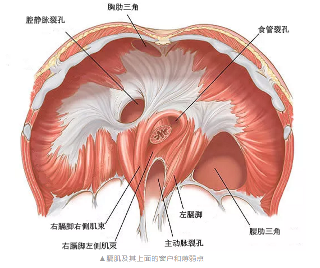 胸腹膜裂孔疝图片