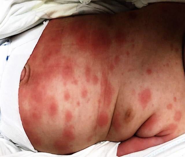 史传奎医生文章_山东大学齐鲁儿童医院-微医