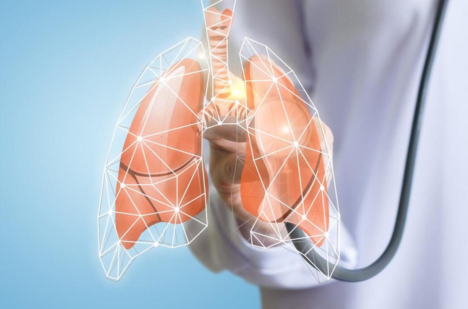 精准定位肺部结节的磁导航气管镜不开刀也能确诊结节性质的检查