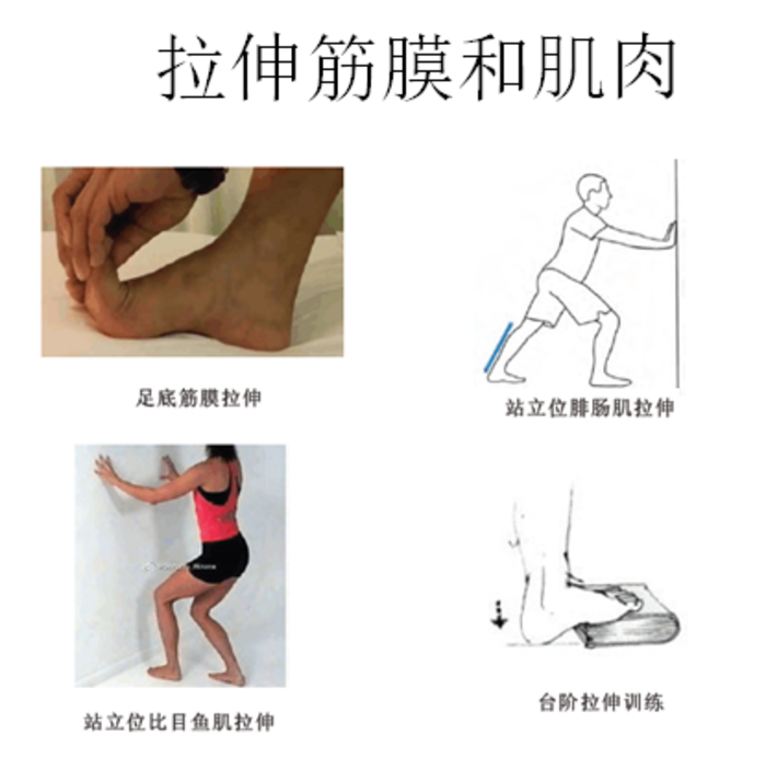 足底筋膜炎的认识与康复