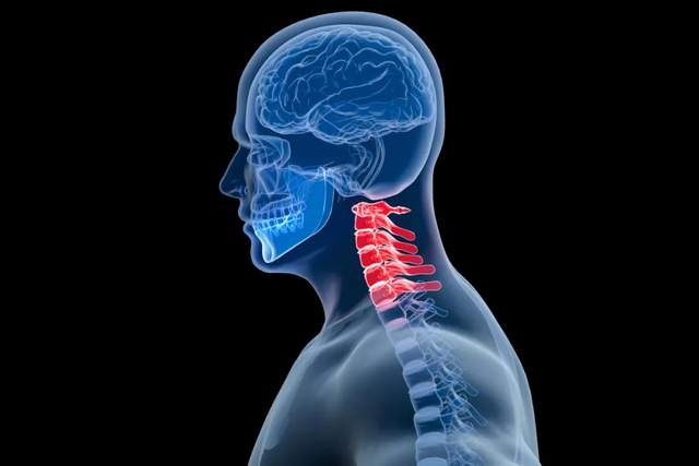 颈椎反曲了靠复位能恢复吗