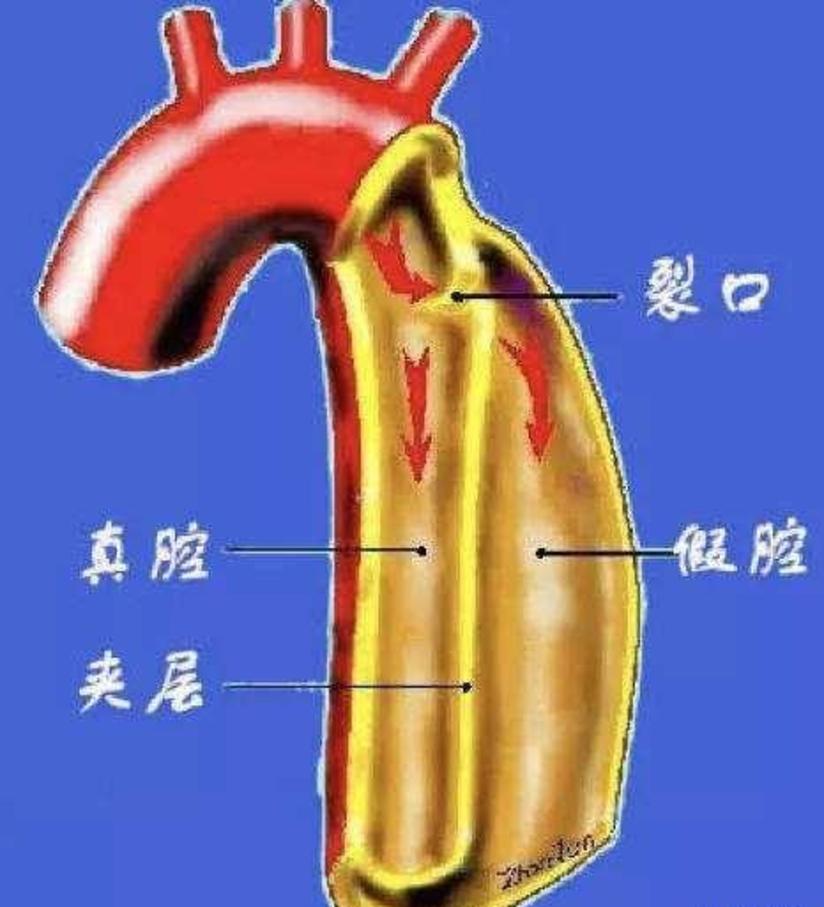 胸背痛就是肺癌 大部分没有相关性 这5种疾病才是最常见病因 健康号 微医