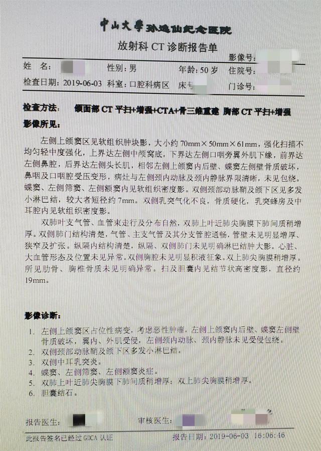 一例鼻咽癌放疗诱导的左上颌颅底骨肉瘤较为棘手的病例