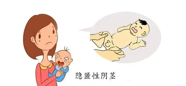 带你认识隐匿性阴茎,"鸡鸡小"长不大是怎么回事?