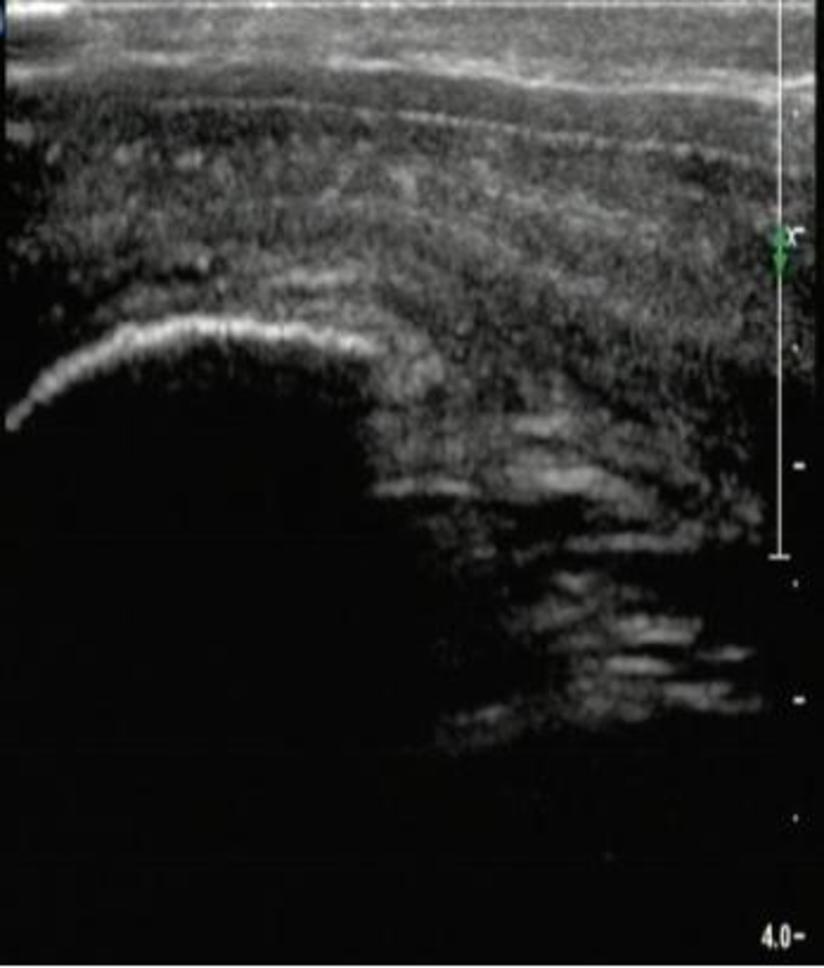 サンディエゴ勃起不全クリニック