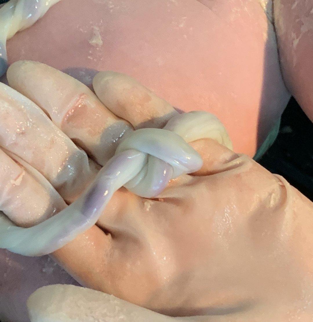 黄帅医生有话说之脐带打结怎么办? - 微医(挂号网)