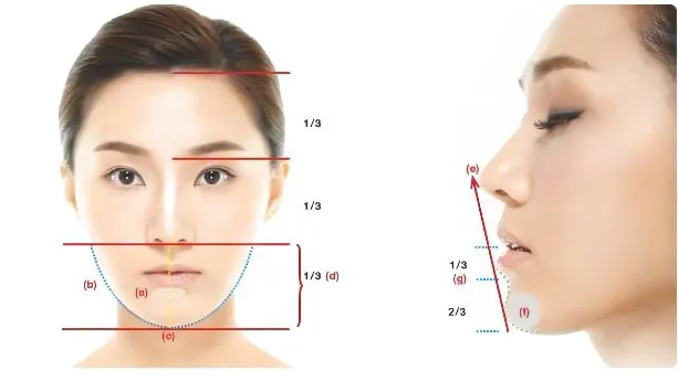 假体隆下巴如何塑造理想形态