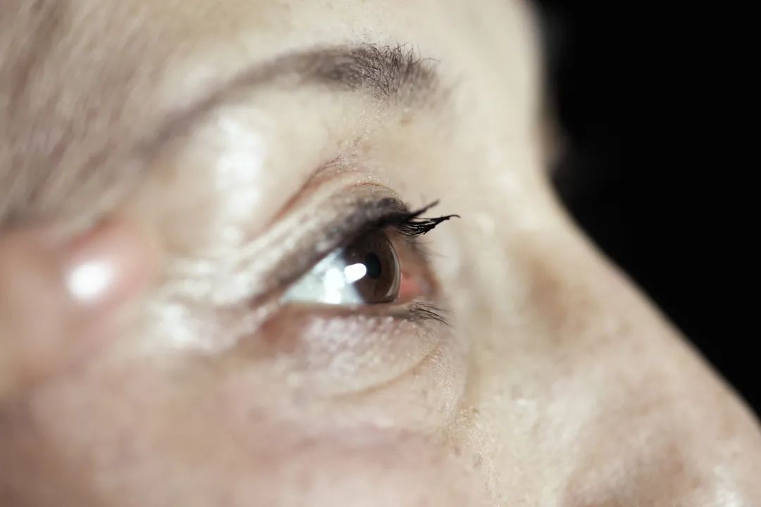 好好的眼睛怎么就看不清了这些眼部疾病可能让你变瞎