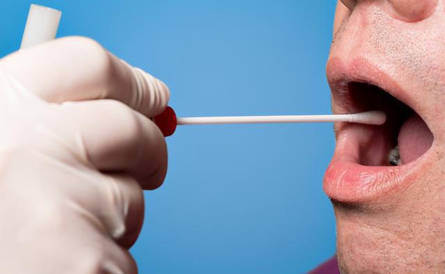 唾液采集的dna并非唾液本身的dna,主要是搜集唾液中脱落的口腔上皮