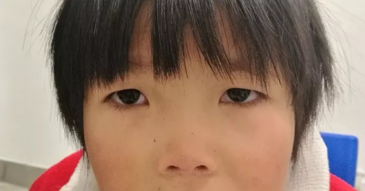 rgp和ok镜和一般的软性隐形眼镜有什么区别?