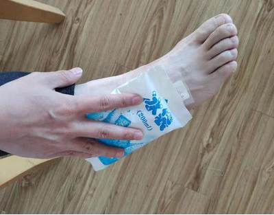 踝关节保守治疗的效果