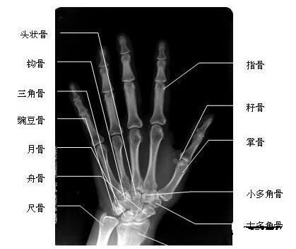 特点: 前臂尺侧不适, 手掌手背尺侧, 小指, 无名指感觉麻木