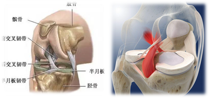 什么是交叉韧带损伤