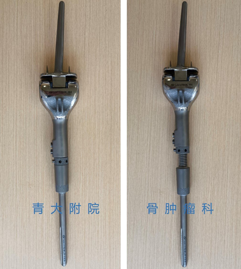 典型病例可延长肿瘤型膝关节假体治疗儿童膝关节胫骨近端骨肉瘤