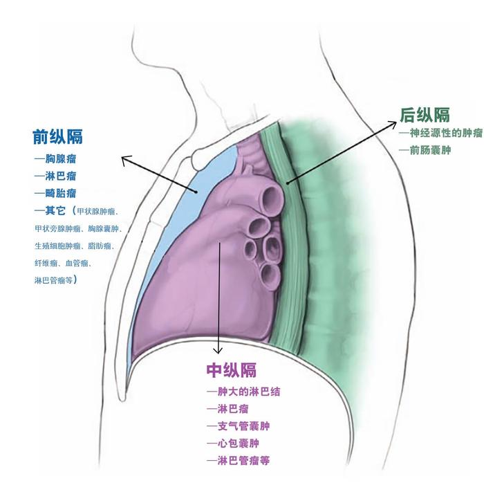 聚焦宁波胸外科：呼吸健康的守护者